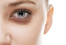 Göz Altı Morlukları Nasıl Geçer