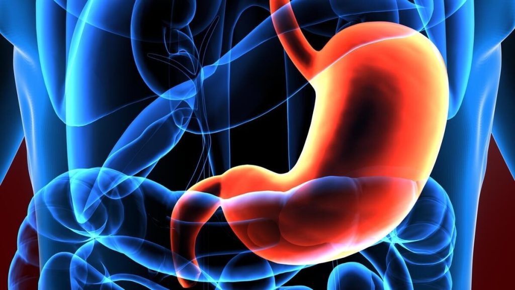 Bağırsak Reflüsü